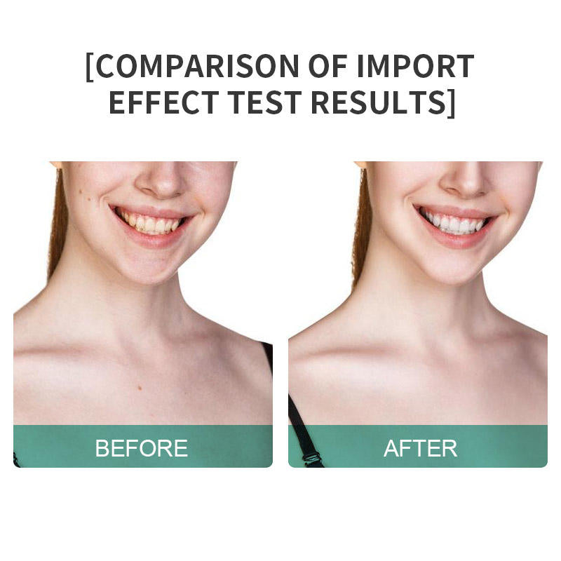Contour — Microcurrent Face & Neck Device
