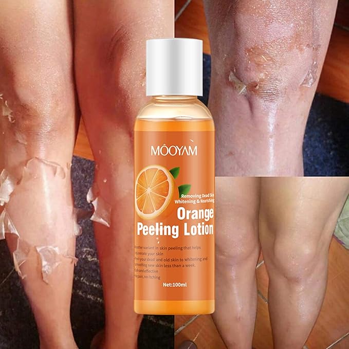 Orange peeling gel use